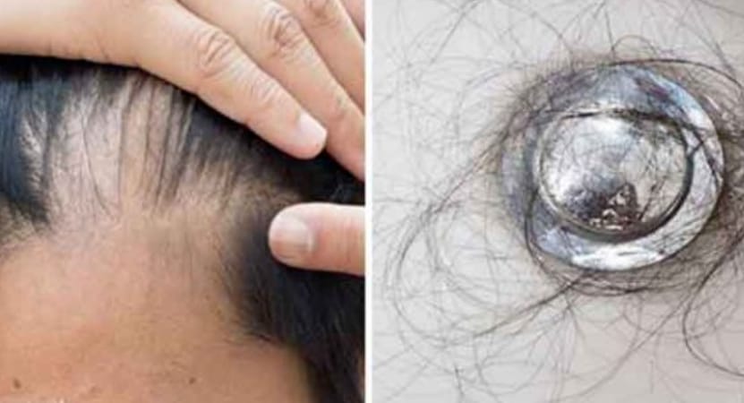 Po përballeni me rënie të menjëherëshme të flokëve? Zbulojeni se çfarë e shkakton