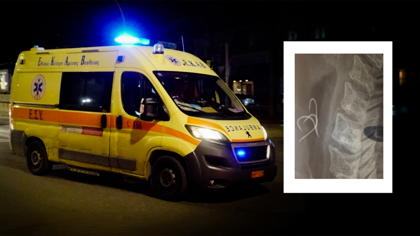 “U bëra blu, nuk merrja dot frymë”, 38-vjeçari në Greqi gëlltit tre grepa teksa hante oktapod