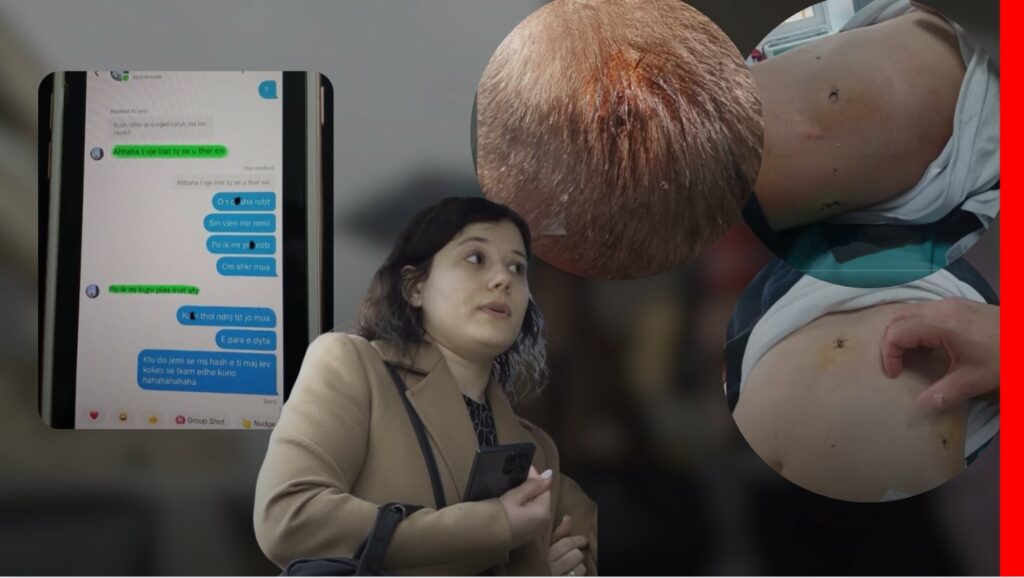 17-vjeçari goditet 3 herë me thikë, parregullsitë në hetim lënë të lirë autorët