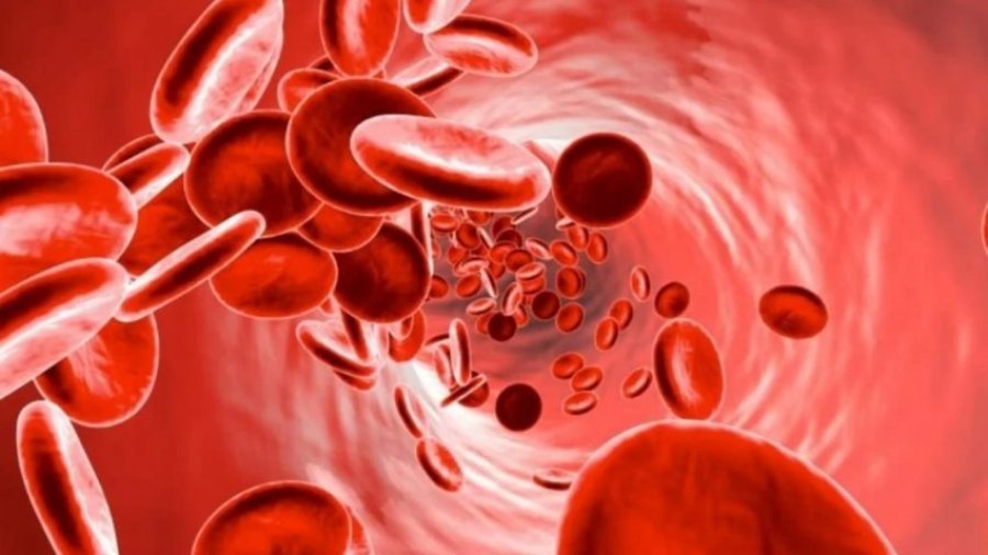 Anemia, rrezik i fshehtë për shëndetin! Simptomat që nuk duhet t’i injoroni