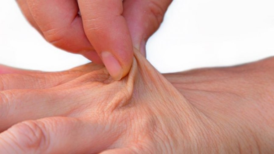 Cilat janë disa shenja që tregojnë se jeni të dehidratuar?