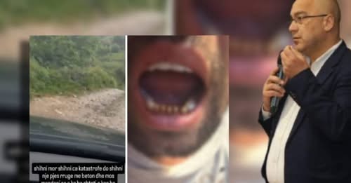 I riu denoncoi gjendjen skandaloze të rrugës, dy zyrtarët e PS e dhunojnë (VIDEO)