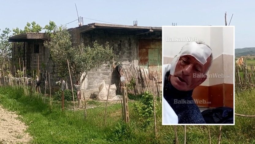 Plagosja në Lushnje/ Djali i Flamur Manes rrëzon versionin e policisë: Donin të më vrisnin babanë, familjet tona në konflikt prej 10 vitesh!