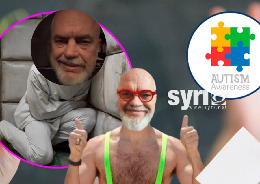 Sulmoi fëmijët me spektër autik/ Rama trash skandalin: E kam lexuar në literaturën politike