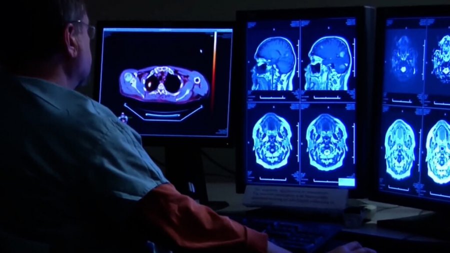 Të moshuarit që përdorin teknologjinë rrezikohen më pak nga demenca