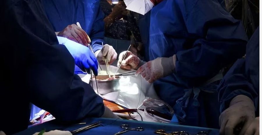 Transplant i rrallë i mëlçisë! 14 orë operacion te një 21-vjeçare me një teknikë të re