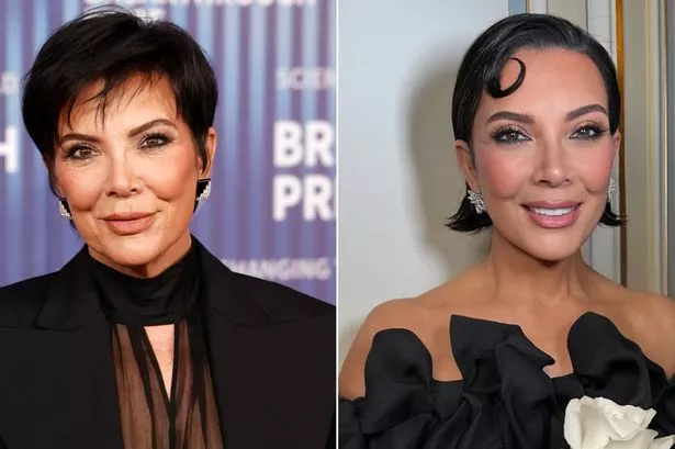 Duket moshatare me vajzat e saj, zbulohet kirurgu plastik që bëri Kriss Jenner të duket 30 vite më e re