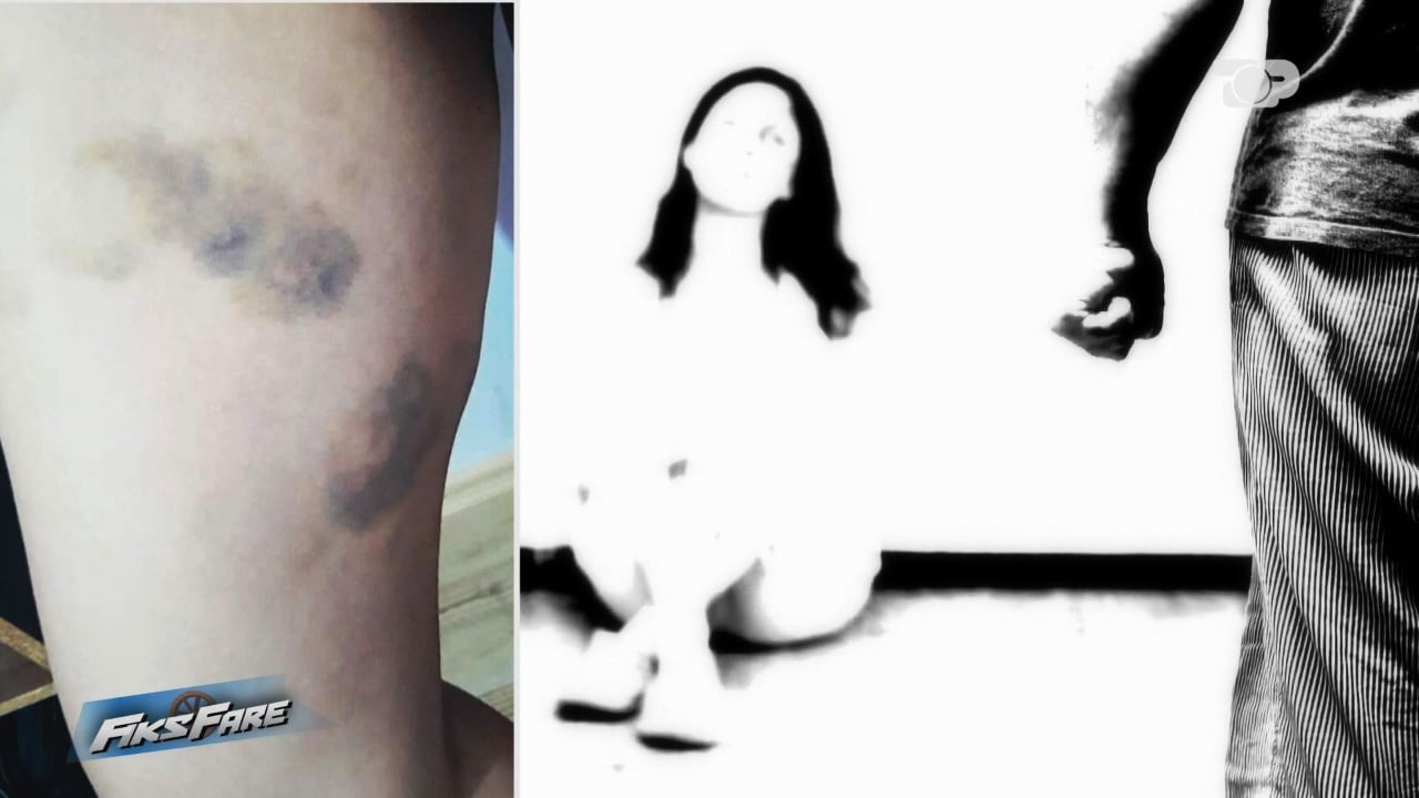 Fiks Fare/ “Nga dhuna e burrit humba fëmijën”, nëna e dy të miturve kërkon drejtësi. Psikiatrja pohon se është psikopat, në raport rezulton normal