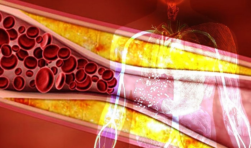 Këto janë frutat që pastrojnë enët e gjakut nga yndyra! Konsumojini, nëse doni një sistem kardiovaskular të shëndetshëm