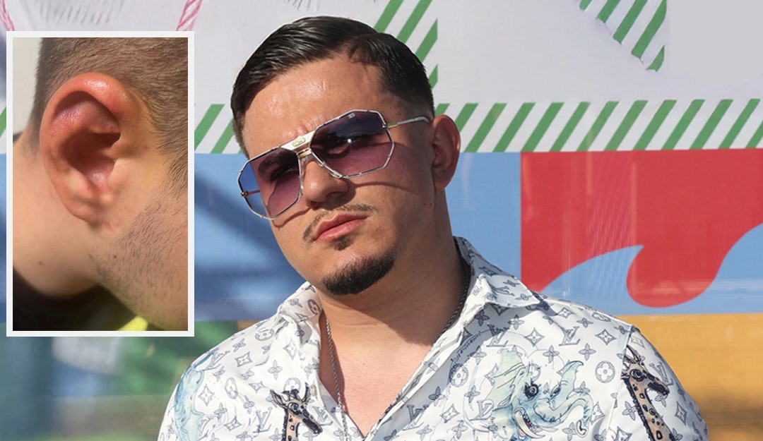 Rrëmbehet dhe torturohet djali i biznesmenit grek, autorët kërkuan 25 mijë për ta lënë të lirë