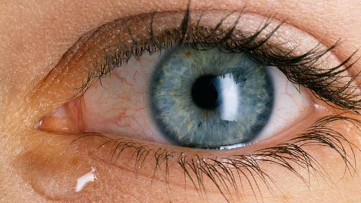 Tensioni i Syrit – Shkaqet, Shenjat dhe Kur Duhet të Shkoni Patjetër te Mjeku