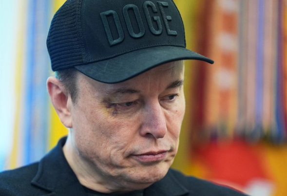 U shfaq me sy të nxirë në krah të Donald Trump, Musk zbulon se kush e goditi me grusht