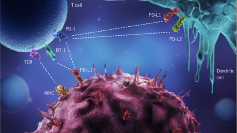 Alarm për kancerin e stomakut në Shqipëri! Mjekët: 13 të prekur në 100 mijë banorë, haset edhe moshat e reja