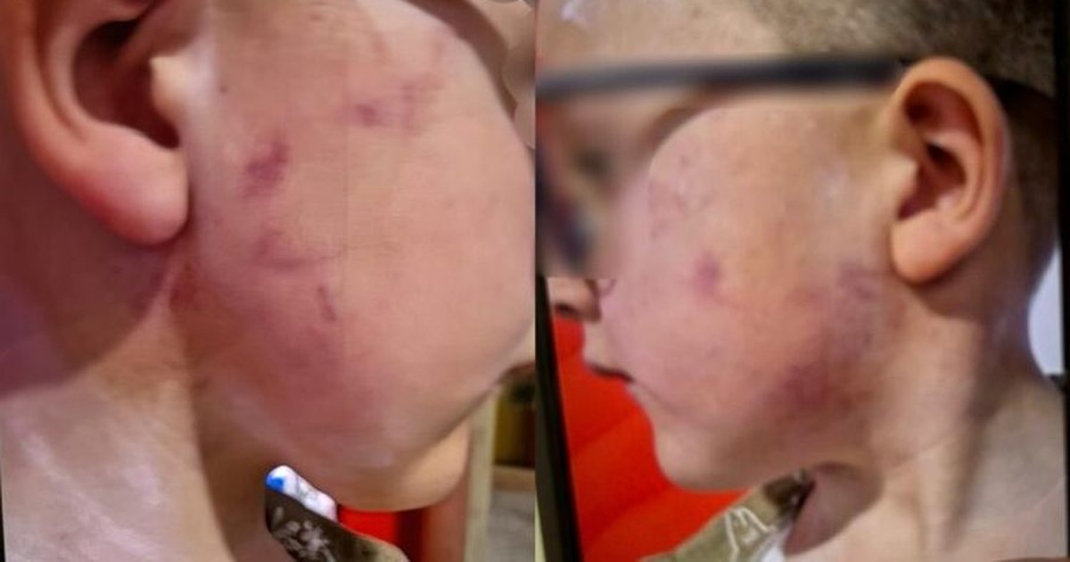 Djalin e mori nga kopshti me shenja të nxira në fytyrë! Pronarja e ‘Gledis’ denoncon nënën: Më prishi imazhin