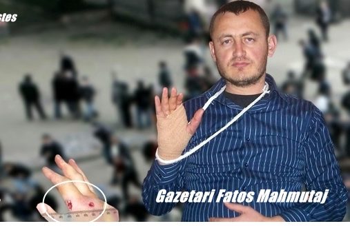 Fatos Mahmutaj zbulon prapaskenat e errëta të masakrës së “21 janarit”: Ja si u plagosa në protestë…