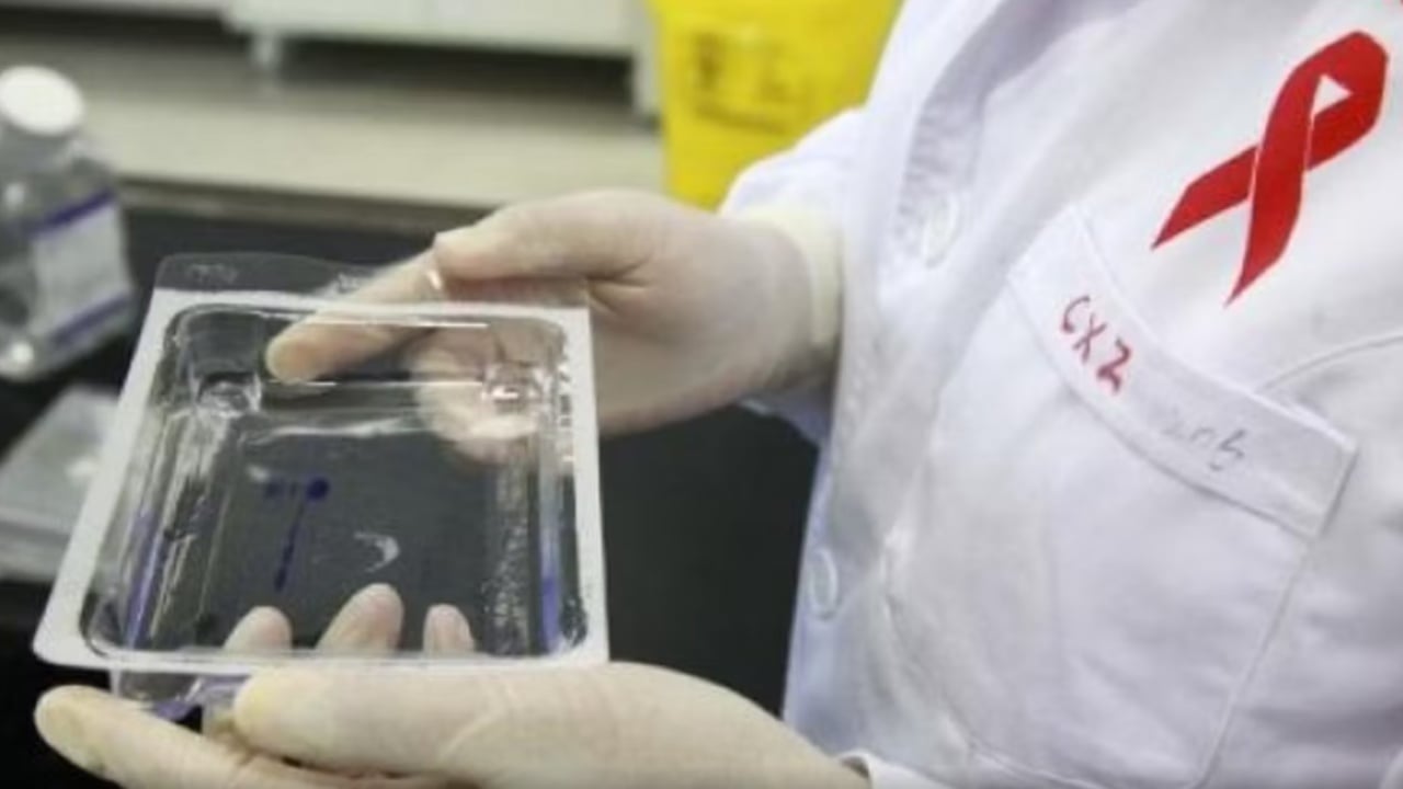 Ilaç i ri kundër HIV/Aids, do injektohet në mënyrë semestrale