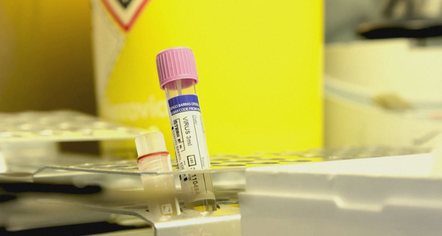 Lia e majmunit në Shqipëri, si u zbulua 31-vjeçari i prekur, shenjat dhe trajtimi i tij