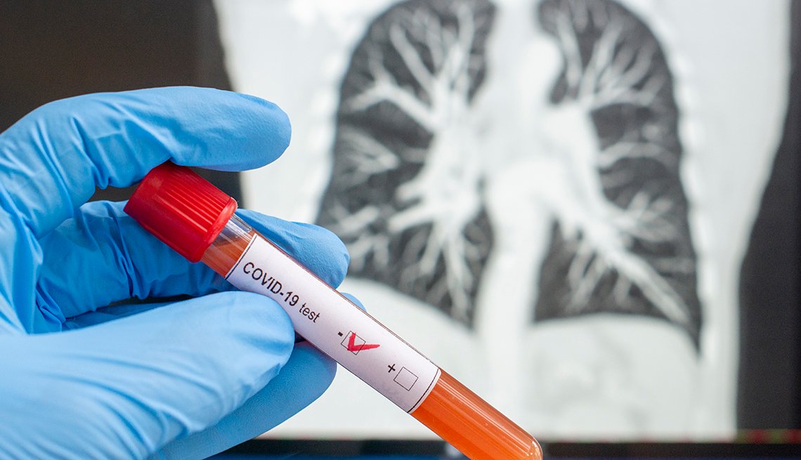 OBSH-ja, publikon raportin përfundimtar të Covid-19: Nuk e gjejmë dot origjinën!