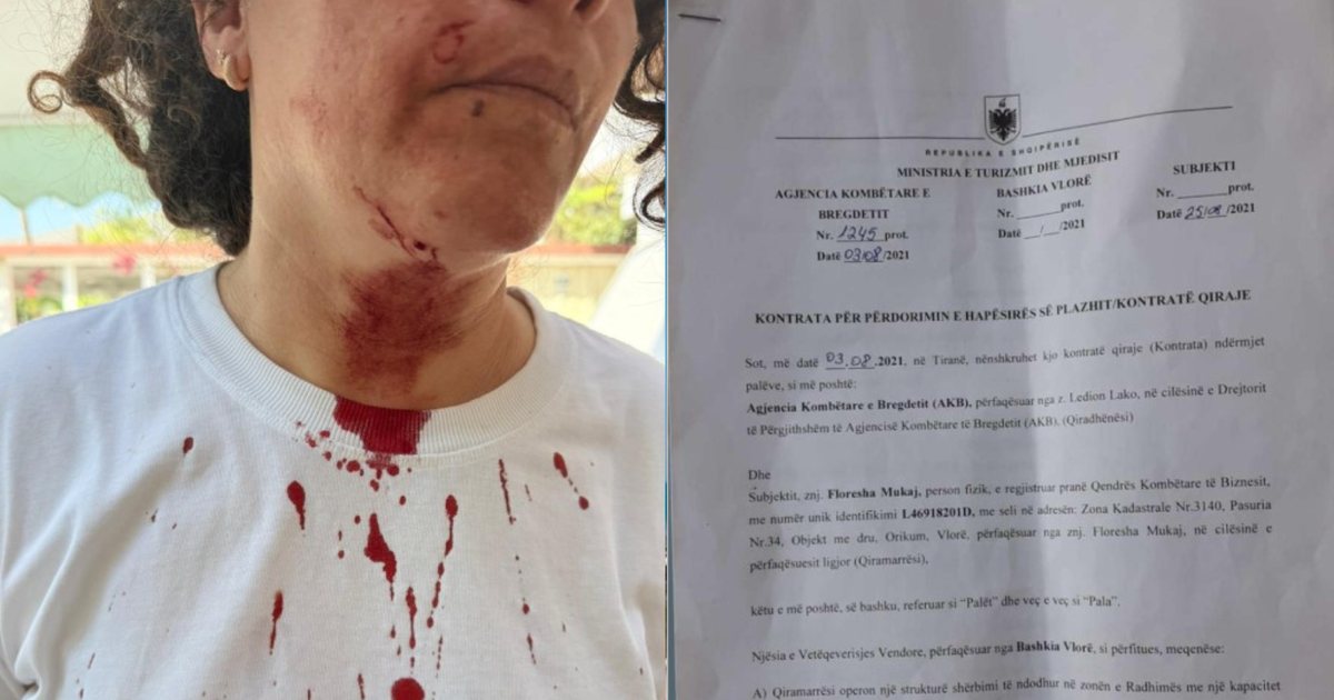 Përplasje për hapësirën e plazhit në Radhimë, dy persona përfundojnë në spital nga dhuna