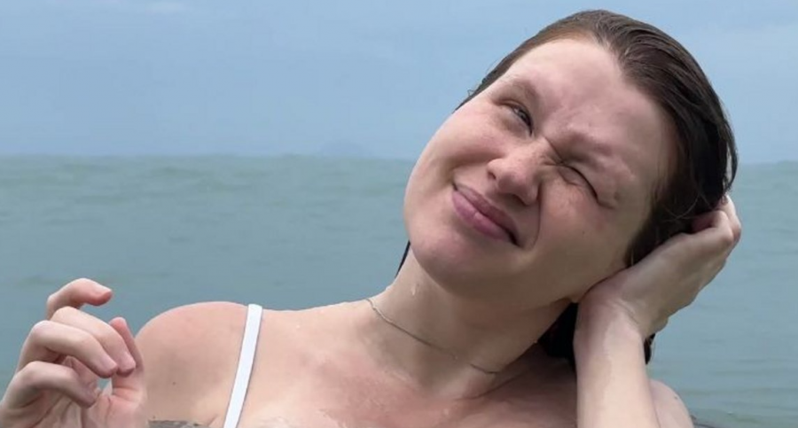 Çfarë është sëmundja e notarit? Këshilla si të mjekohet