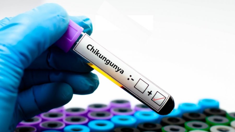 Chikungunya, alarm në Europë/ Epidemi në Francë dhe rast i parë i konfirmuar në Itali, OBSH paralajmëron rrezik global