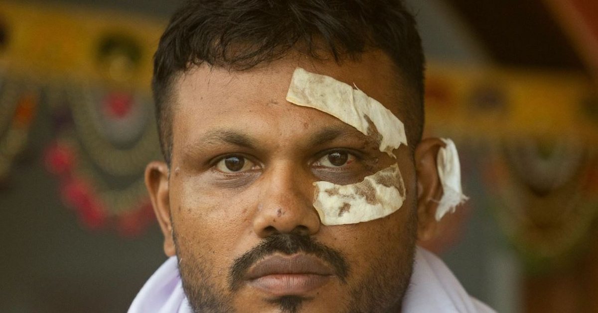 I vetmi që mbijetoi nga avioni “Air India”, por jeta e “njeriut mrekulli” është kthyer në makth