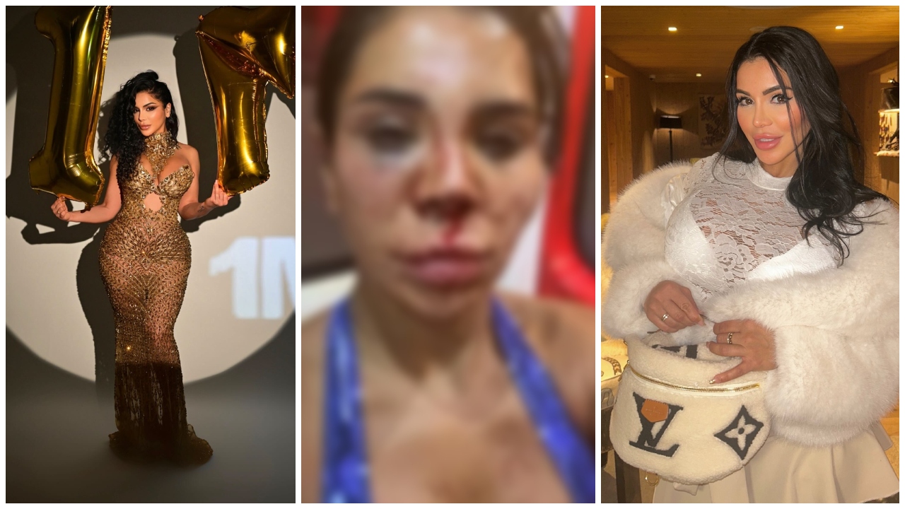 Influencerja e njohur përjeton tmerr, hajdutët i hyjnë në shtëpi dhe e rrahin brutalisht, dyshohet për abuzim seksual