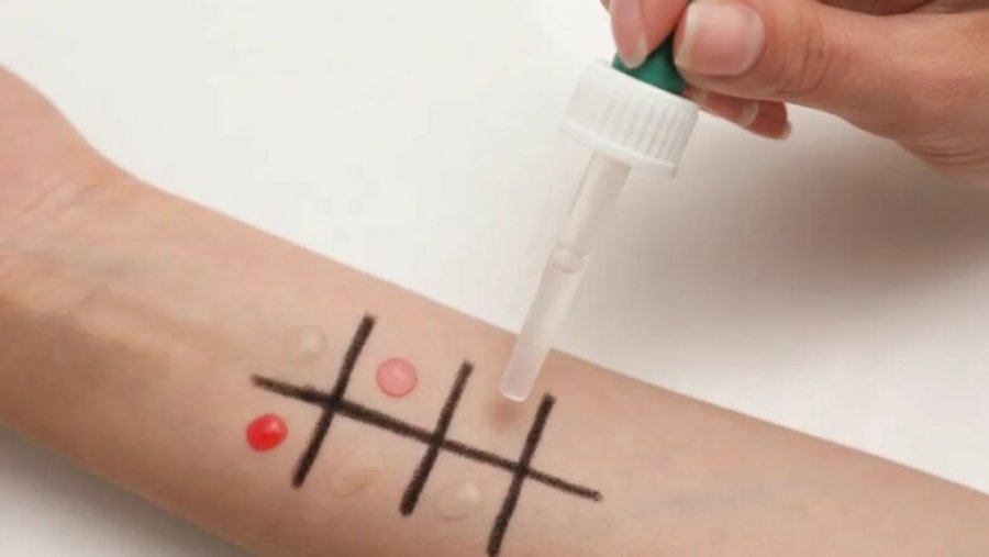 Ndoshta jeni alergjik ndaj hudhrës, pa e ditur, kontrolloni këto simptoma