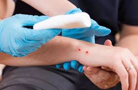 Shtohen pickimet nga gjarpri, rastet kryesisht në zonat rurale, pajisen qendrat shëndetësore me ilaçe