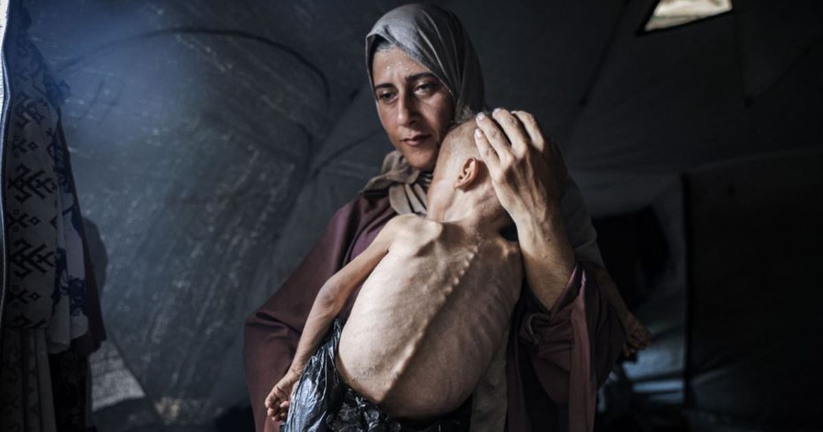 Spitalet e Gazës janë “ferr në Tokë”/ Mjekëve dhe infermierëve u bie të fikët nga uria