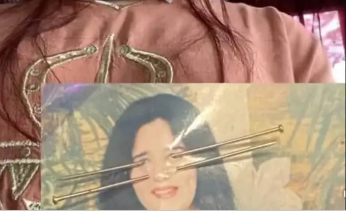 Tronditëse/ I bënë magji me foton e saj, e reja pëson deformime drastike në pamje (Foto)