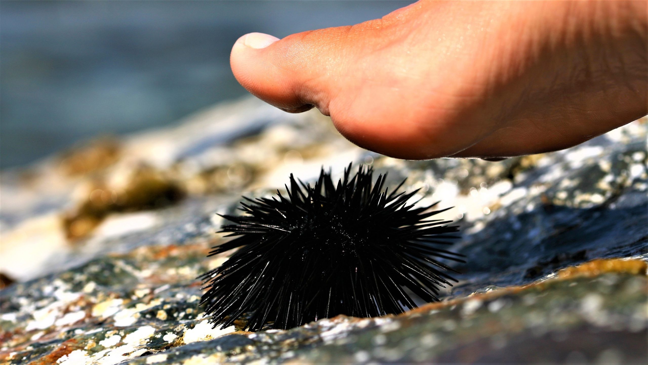 Vëmendje! Çfarë nuk duhet të bëni nëse shkelni një iriq deti