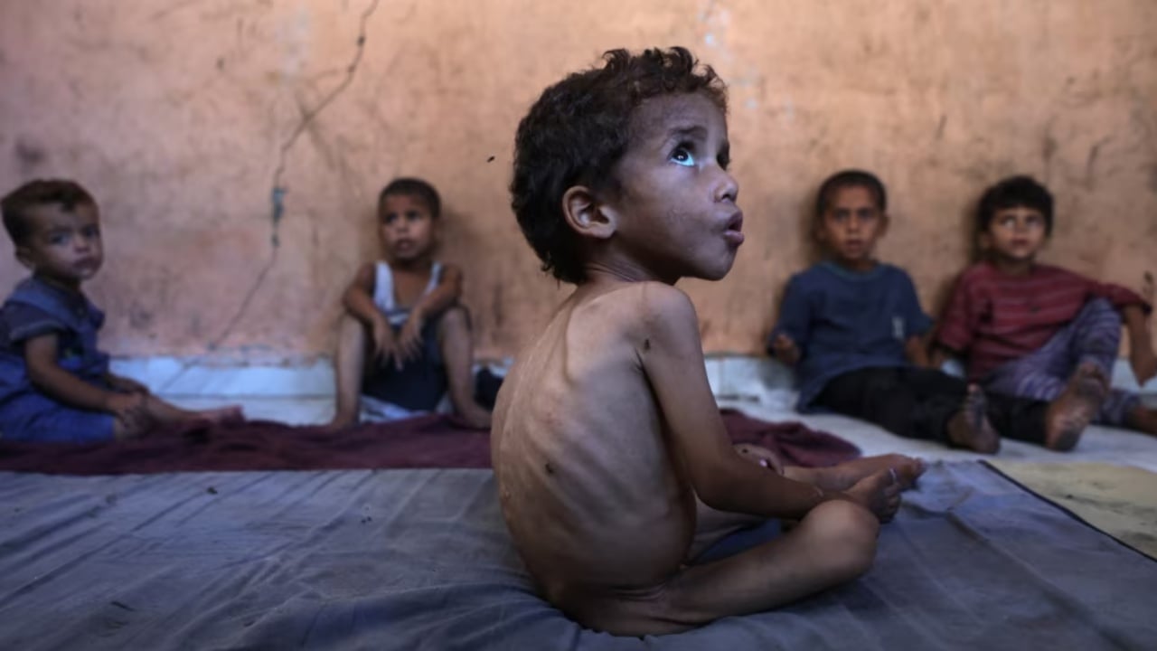 “Amnesty International” akuza Izraelit: Po aplikon një politikë të qëllimshme për të shkaktuar uri në Gazë!