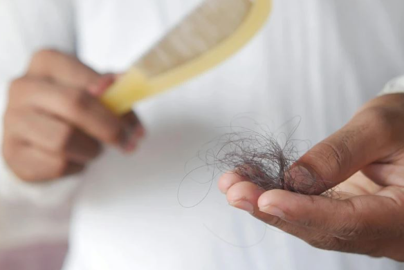 Kjo pije çon në rënien e flokëve