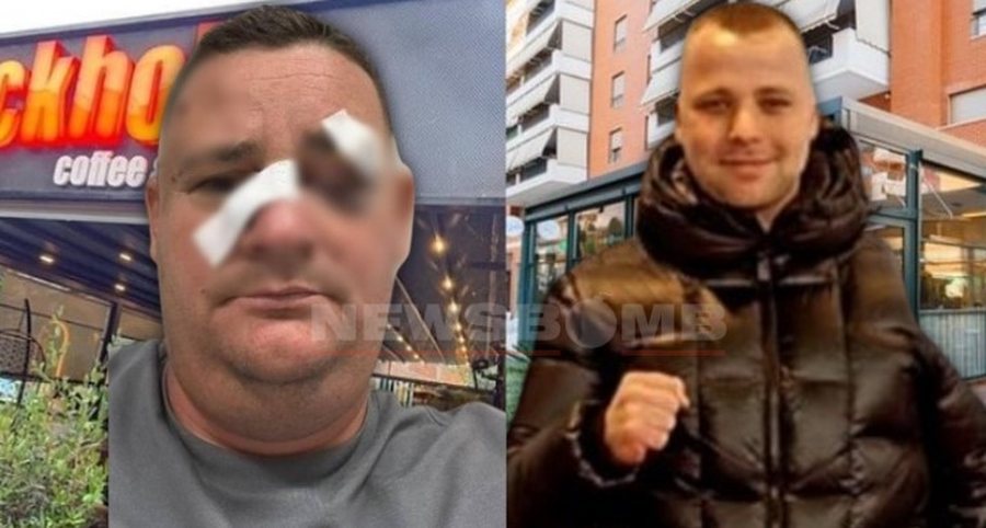 Merr fund arratia e pronarit të “Stockholm”! Kush është Ferhat Kraja, biznesmeni që dhunoi kundërshtarin e tij