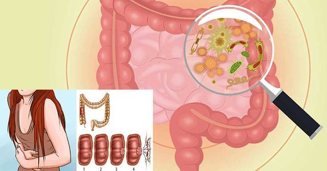 Mos i injoroni! Këto janë shenjat e kancerit të zorrës së trashë!