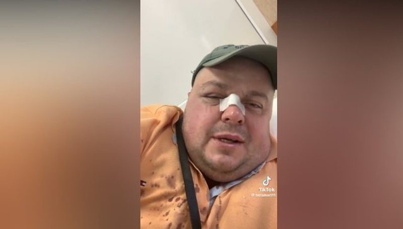 “Pse bëni zhurmë në lokal?”/ Zbulohet arsyeja pse u dhunua, Genard Hajdini dhe babai i tij