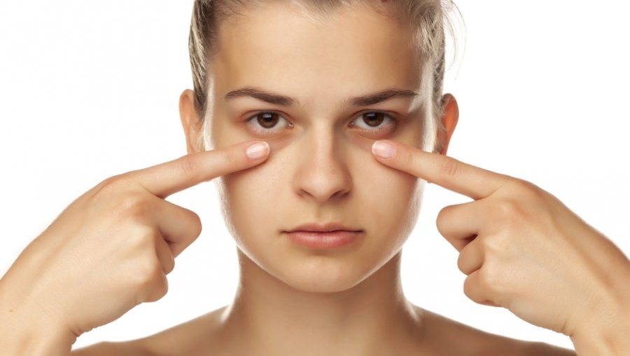 Qeset poshtë syve: çfarë problemesh shëndetësore mund të fshehin