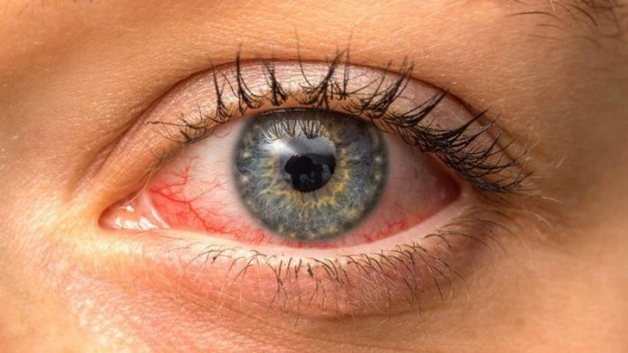 Tharja e syve nga telefoni, kujdesi që duhet të tregoni