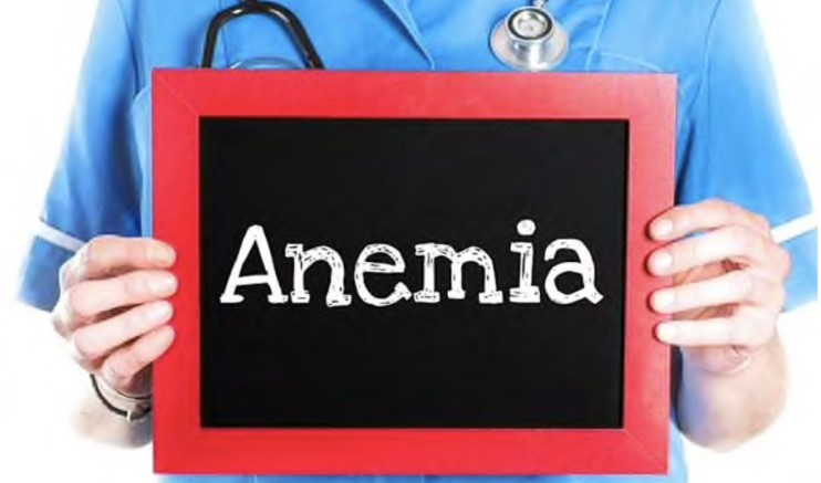 Anemia, produktet që rrisin përthithjen e hekurit nga trupi