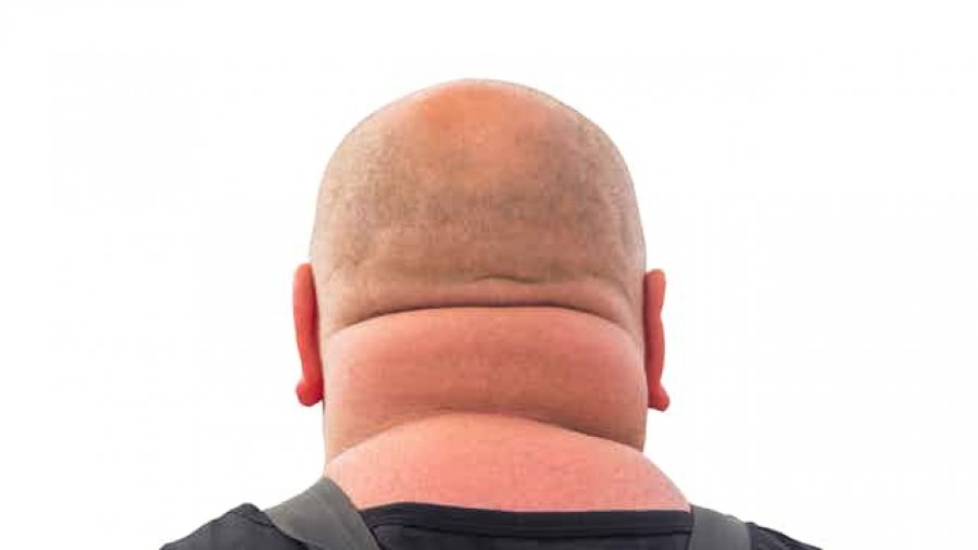 Çfarë tregon madhësia e qafës për shëndetin tuaj