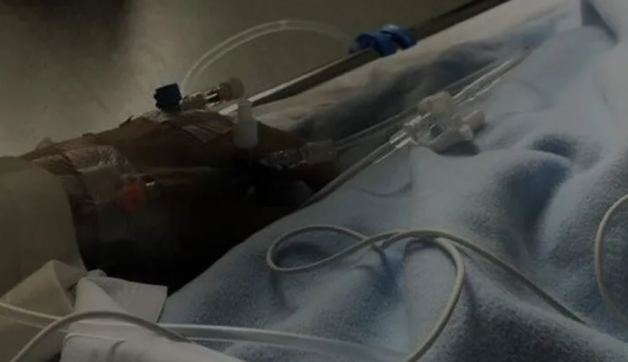 Familjarët kërkojnë ndihmë për kurimin e kamarieres së plagosur në atentatin e Shkodrës: S’i përballojmë dot faturat