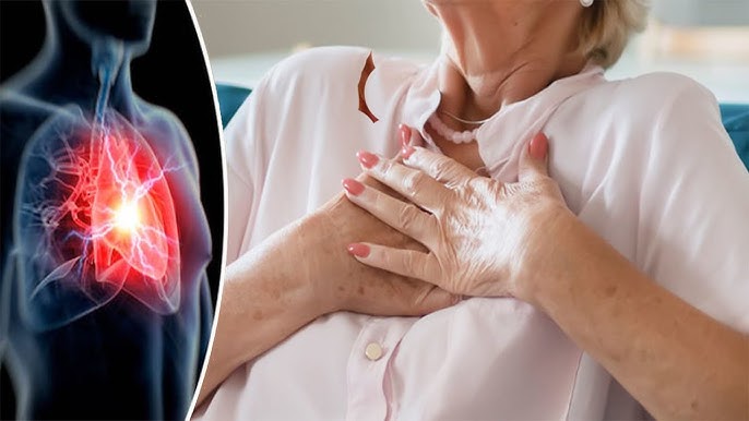 Gjashtë shenjat që trupi shfaq përpara atakut kardiak