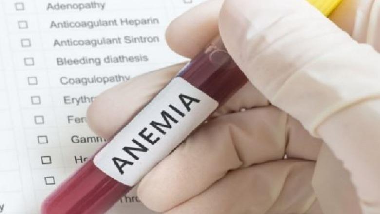 Rastet e anemisë te gratë shqiptarë në rritje, ja si të mbroheni sipas ISHP