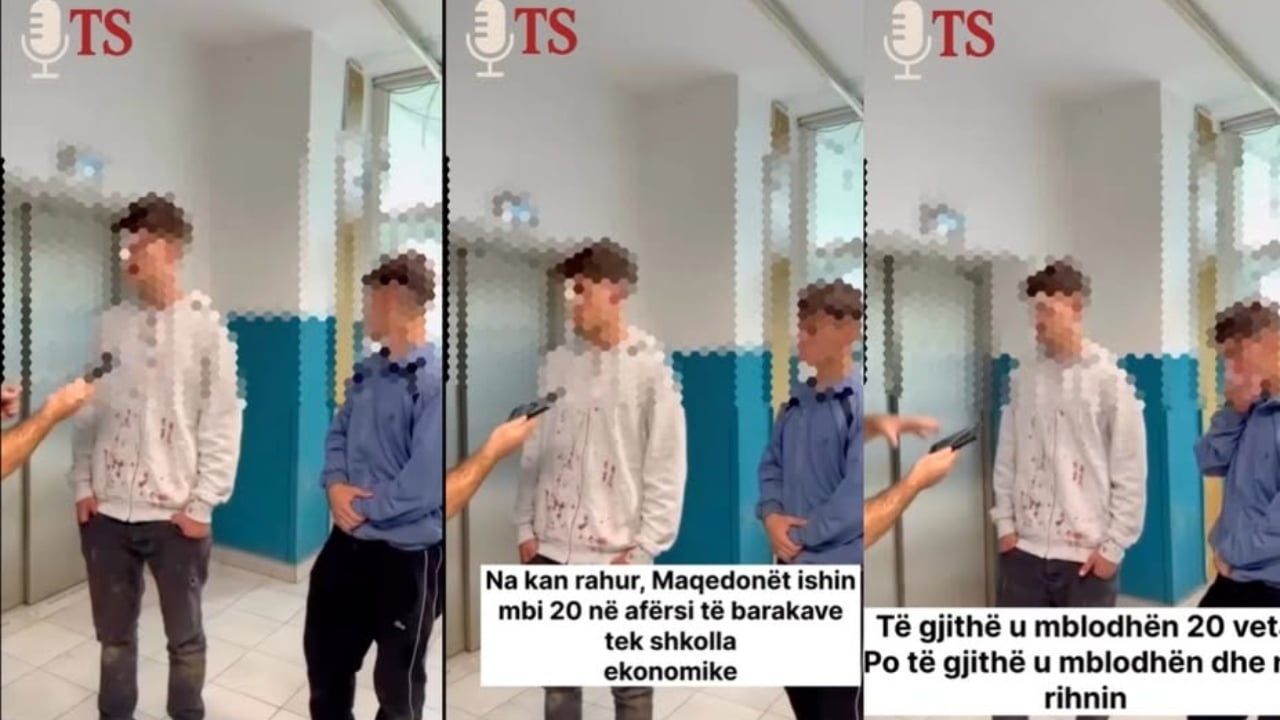 Sulmi i dhunshëm ndaj dy të miturve në Tetovë/ “Shteti po hesht”, reagon Aleanca për Shqiptarët: Akt barbar me sfond etnik