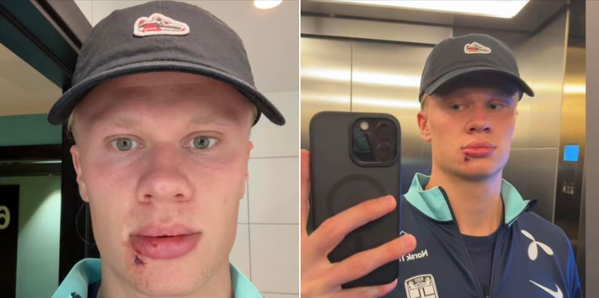 Tri qepje për Haaland, incidenti i pazakontë i yllit norvegjez në kombëtare