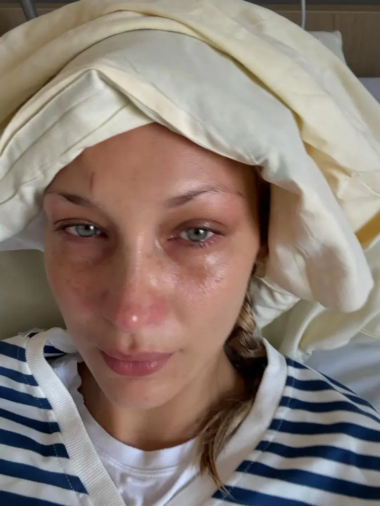 Bella Hadid: Ju që luftoni çdo ditë me ankthin, nuk jeni vetëm