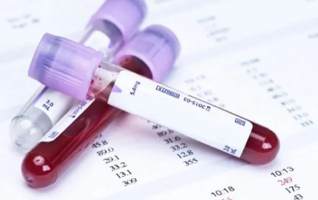 Cili grup i gjakut ka më shumë rrezik për sulme në tru?!