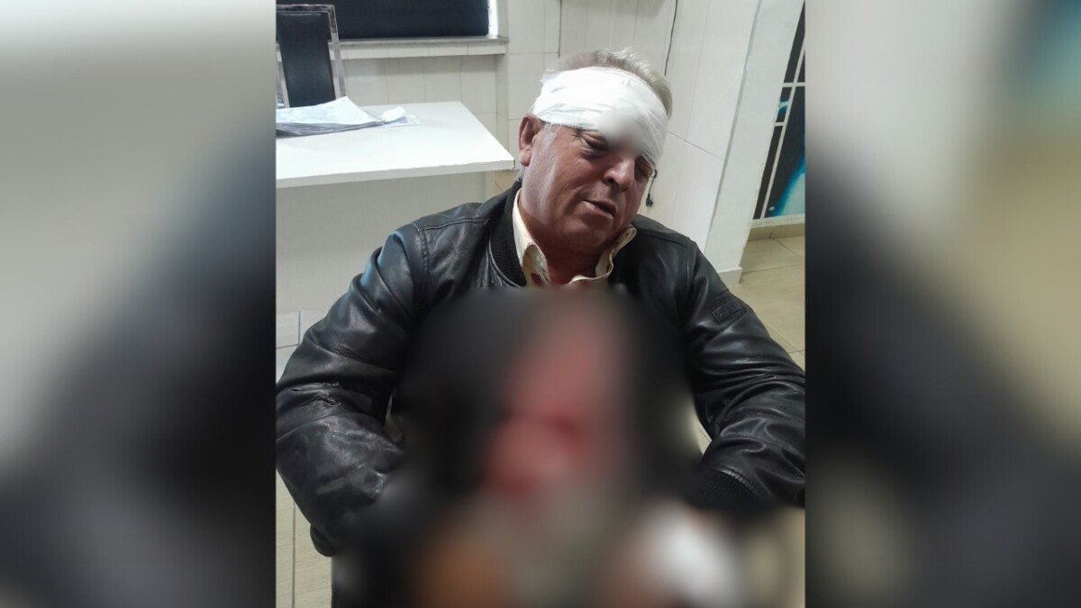 Dhunuan barbarisht punonjësin e pastrimit në Vlorë, arrestohen dy autorët (Emrat)