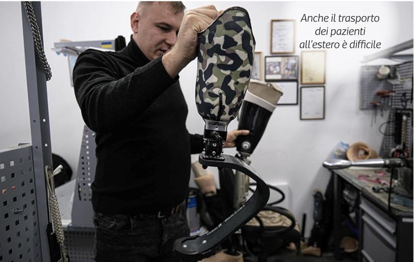 Drama e Ukrainës me 100 mijë persona të amputuar, bëhet “fabrika” më e madhe e protezave në botë